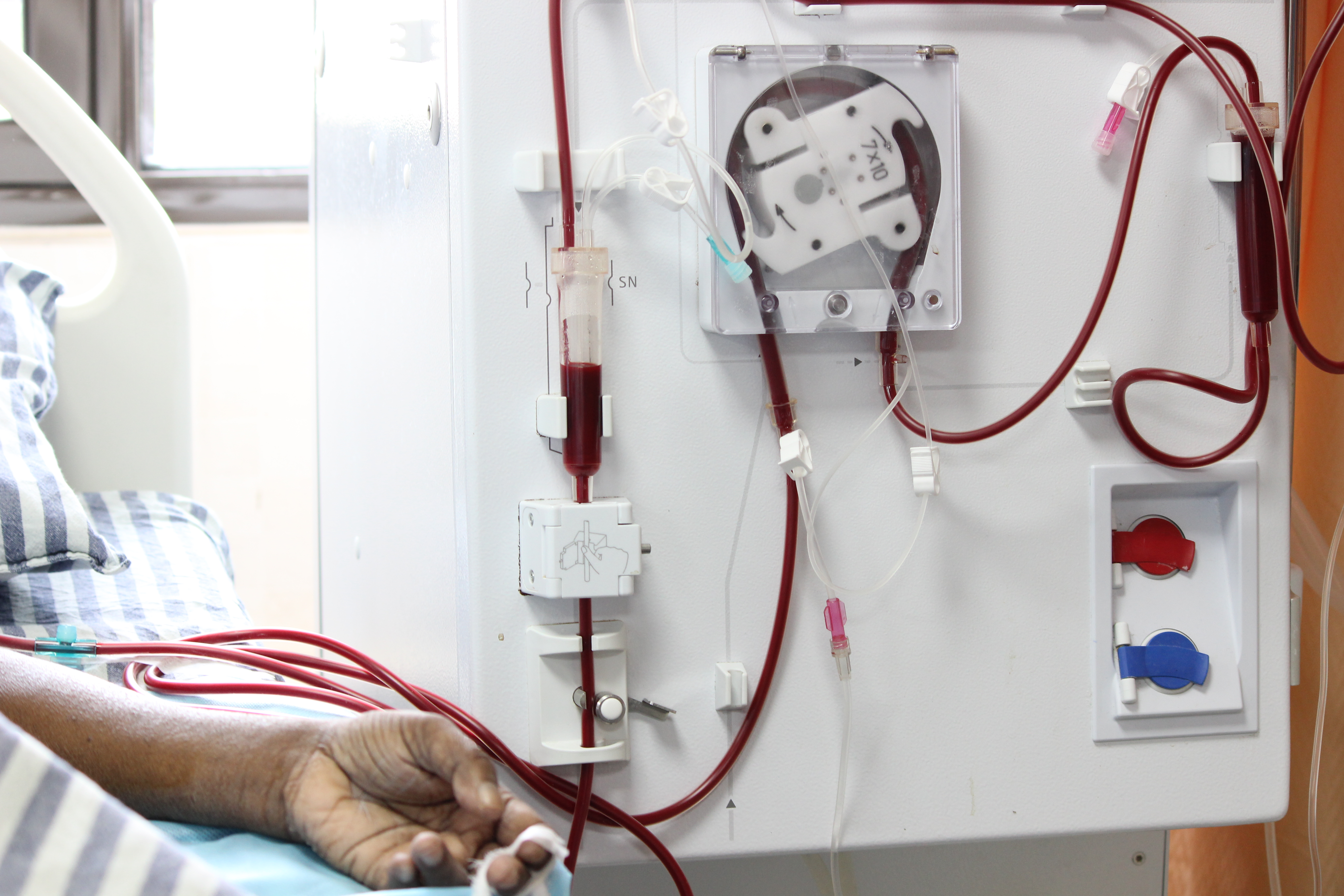 Dialysis Technology